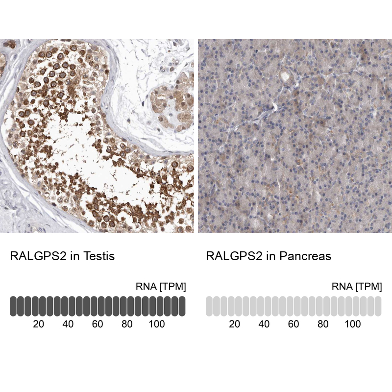 Anti-RALGPS2 Antibody