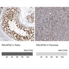 Anti-RALGPS2 Antibody