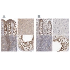 Immunohistochemical staining of human colon, liver, lymph node and testis using Anti-RALGPS2 antibody HPA028328 (A) shows similar protein distribution across tissues to independent antibody HPA027143 (B).