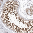 Immunohistochemical staining of human testis shows high expression.