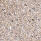 Immunohistochemical staining of human liver using Anti-RALGPS2 antibody HPA028328.
