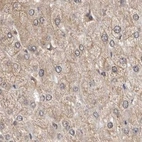 Immunohistochemical staining of human liver using Anti-RALGPS2 antibody HPA028328.