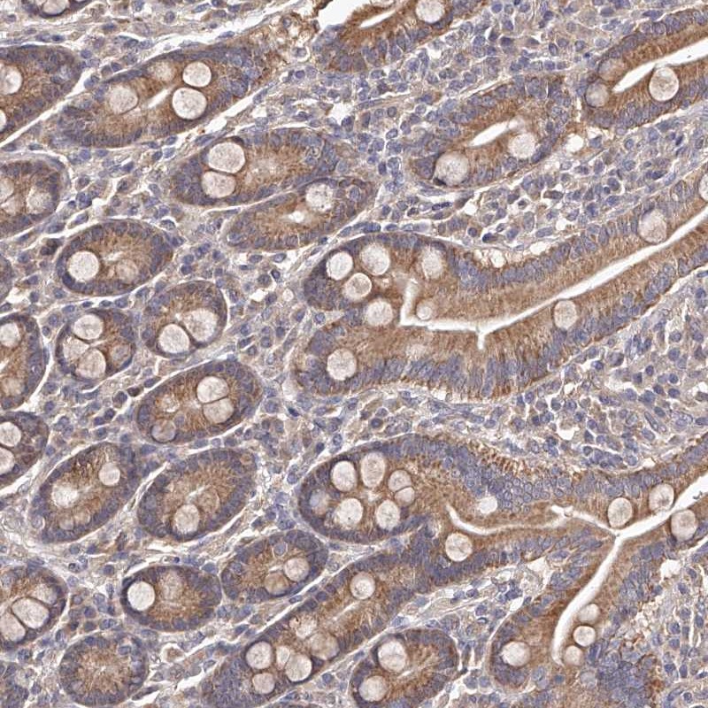 Anti-ODF2L Antibody