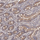Anti-ODF2L Antibody