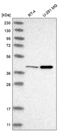 Anti-NME7 Antibody