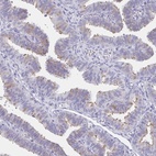 Immunohistochemical staining of human fallopian tube shows high expression.