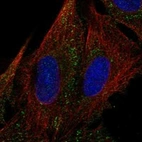 Anti-MYOM3 Antibody