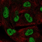 Anti-HORMAD1 Antibody