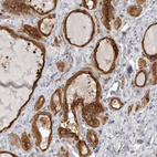 Anti-MINDY1 Antibody