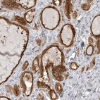 Anti-MINDY1 Antibody
