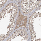 Immunohistochemical staining of human testis shows moderate cytoplasmic positivity in Leydig cells and cells in seminiferous ducts.