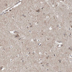 Immunohistochemical staining of human cerebral cortex shows moderate cytoplasmic positivity in neuropil and a subset of neuronal cells.