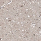 Immunohistochemical staining of human cerebral cortex shows moderate cytoplasmic positivity in neuropil and a subset of neuronal cells.