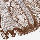 Immunohistochemical staining of human rectum shows strong cytoplasmic positivity in glandular cells.