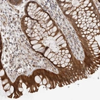 Immunohistochemical staining of human rectum shows strong cytoplasmic positivity in glandular cells.