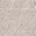 Immunohistochemical staining of human skeletal muscle shows moderate cytoplasmic positivity in myocytes.