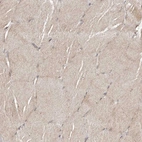 Immunohistochemical staining of human skeletal muscle shows moderate cytoplasmic positivity in myocytes.