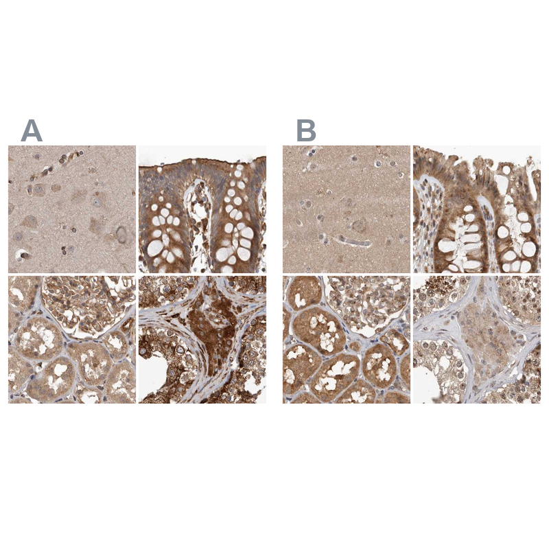Anti-CEP350 Antibody