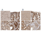 Anti-CEP350 Antibody