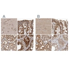 Anti-CEP350 Antibody