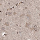 Immunohistochemical staining of human cerebral cortex using Anti-CEP350 antibody HPA028355.
