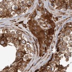 Immunohistochemical staining of human testis using Anti-CEP350 antibody HPA028355.