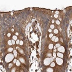 Immunohistochemical staining of human colon using Anti-CEP350 antibody HPA028355.