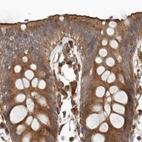Immunohistochemical staining of human colon using Anti-CEP350 antibody HPA028355.