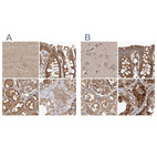 Anti-CEP350 Antibody