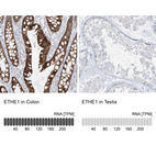 Anti-ETHE1 Antibody