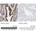 Anti-ETHE1 Antibody