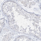 Immunohistochemical staining of human testis shows low expression as expected.