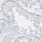Immunohistochemical staining of human testis shows low expression as expected.