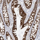 Immunohistochemical staining of human colon shows high expression.