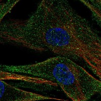 Anti-ADAMTS2 Antibody
