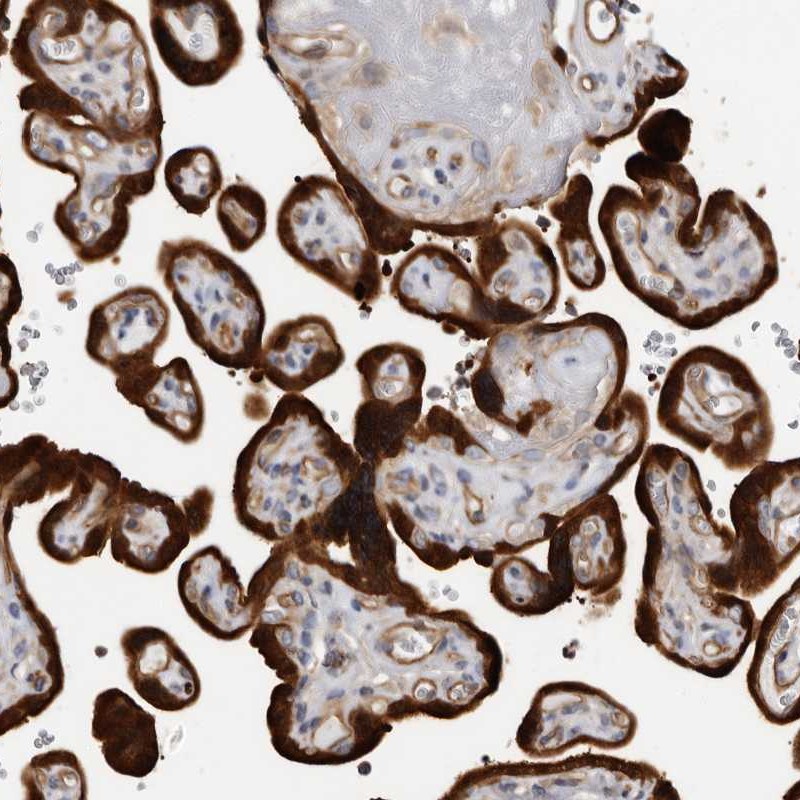 Anti-TCHH Antibody