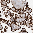 Anti-TCHH Antibody