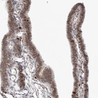 Immunohistochemical staining of human Fallopian tube shows moderate nuclear positivity in glandular cells.