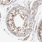 Immunohistochemical staining of human testis shows moderate nuclear positivity in cells in seminiferous ducts.