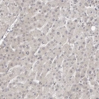 Immunohistochemical staining of human liver shows no positivity in hepatocytes as expected.