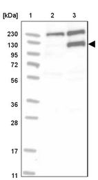 Lane 1: Marker [kDa] 230, 130, 95, 72, 56, 36, 28, 17, 11_br/_Lane 2: Human cell line RT-4_br/_Lane 3: Human cell line U-251MG sp