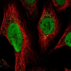 Immunofluorescent staining of human cell line U-2 OS shows localization to nucleoplasm & vesicles.