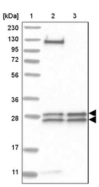 Lane 1: Marker [kDa] 230, 130, 95, 72, 56, 36, 28, 17, 11_br/_Lane 2: Human cell line RT-4_br/_Lane 3: Human cell line U-251MG sp