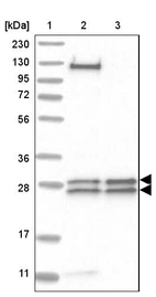 Lane 1: Marker [kDa] 230, 130, 95, 72, 56, 36, 28, 17, 11_br/_Lane 2: Human cell line RT-4_br/_Lane 3: Human cell line U-251MG sp