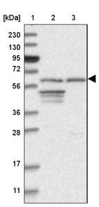 Lane 1: Marker [kDa] 230, 130, 95, 72, 56, 36, 28, 17, 11_br/_Lane 2: Human cell line RT-4_br/_Lane 3: Human cell line U-251MG sp