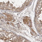 Immunohistochemical staining of human testis shows moderate cytoplasmic positivity in Leydig cells and cells in seminiferous ducts.