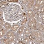 Immunohistochemical staining of human kidney shows weak to moderate cytoplasmic positivity in cells in tubules.