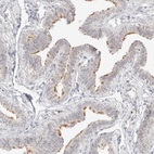 Anti-GNAS Antibody