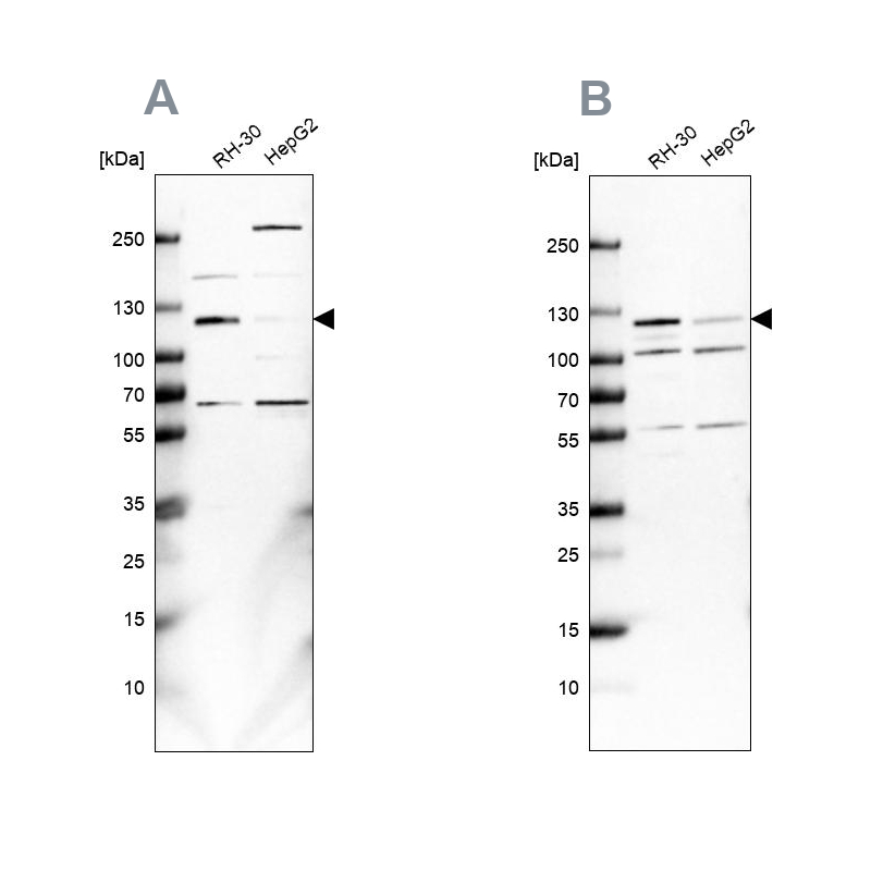 Anti-USP1 Antibody