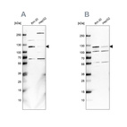 Anti-USP1 Antibody